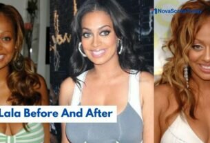 Lala Before And After