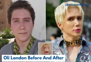 oli london before and after