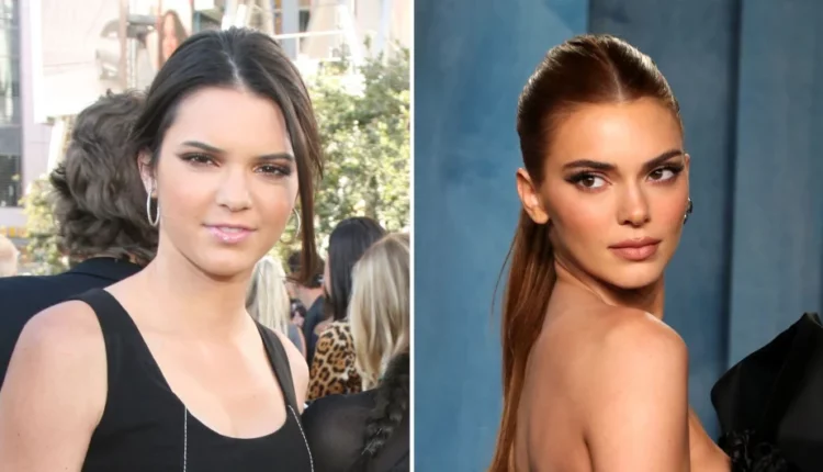 Kendall Jenner before and after