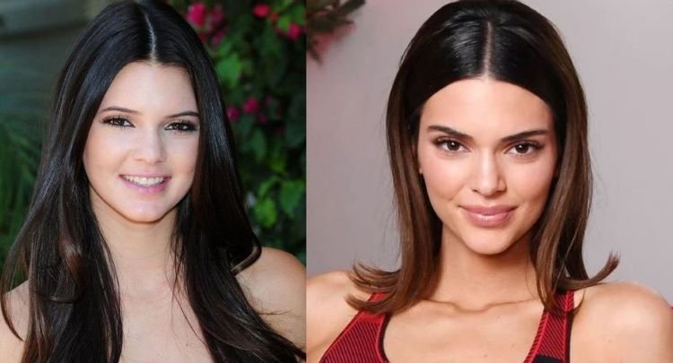 Kendall Jenner before and after