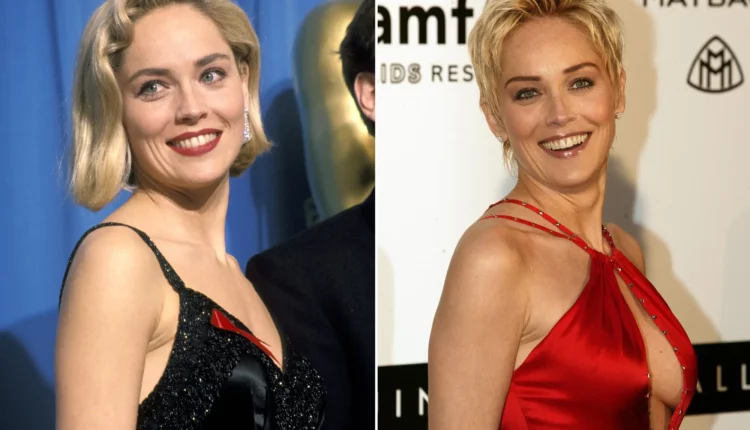 Sharon-Stone-Before-and-After-Cosmetic-Surgery