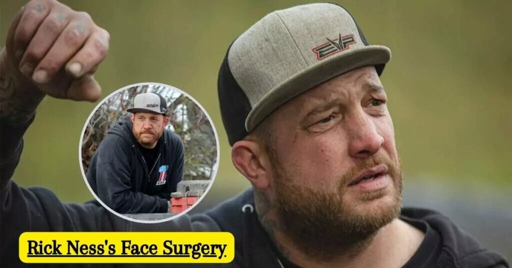 Rick Ness Face Surgery